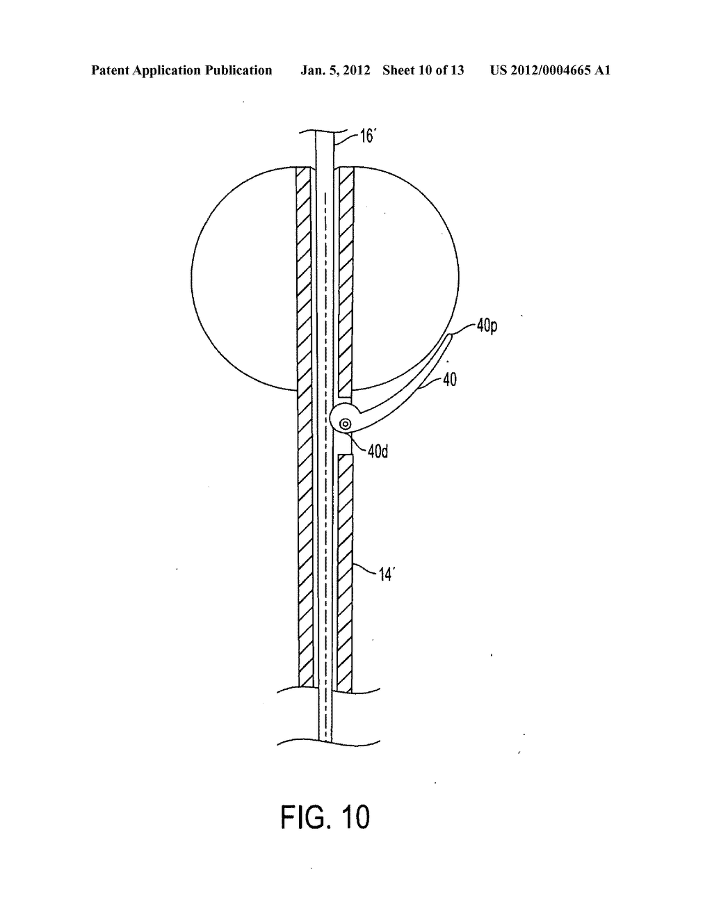 GUIDEWIRE INSERTION METHODS AND DEVICES - diagram, schematic, and image 11