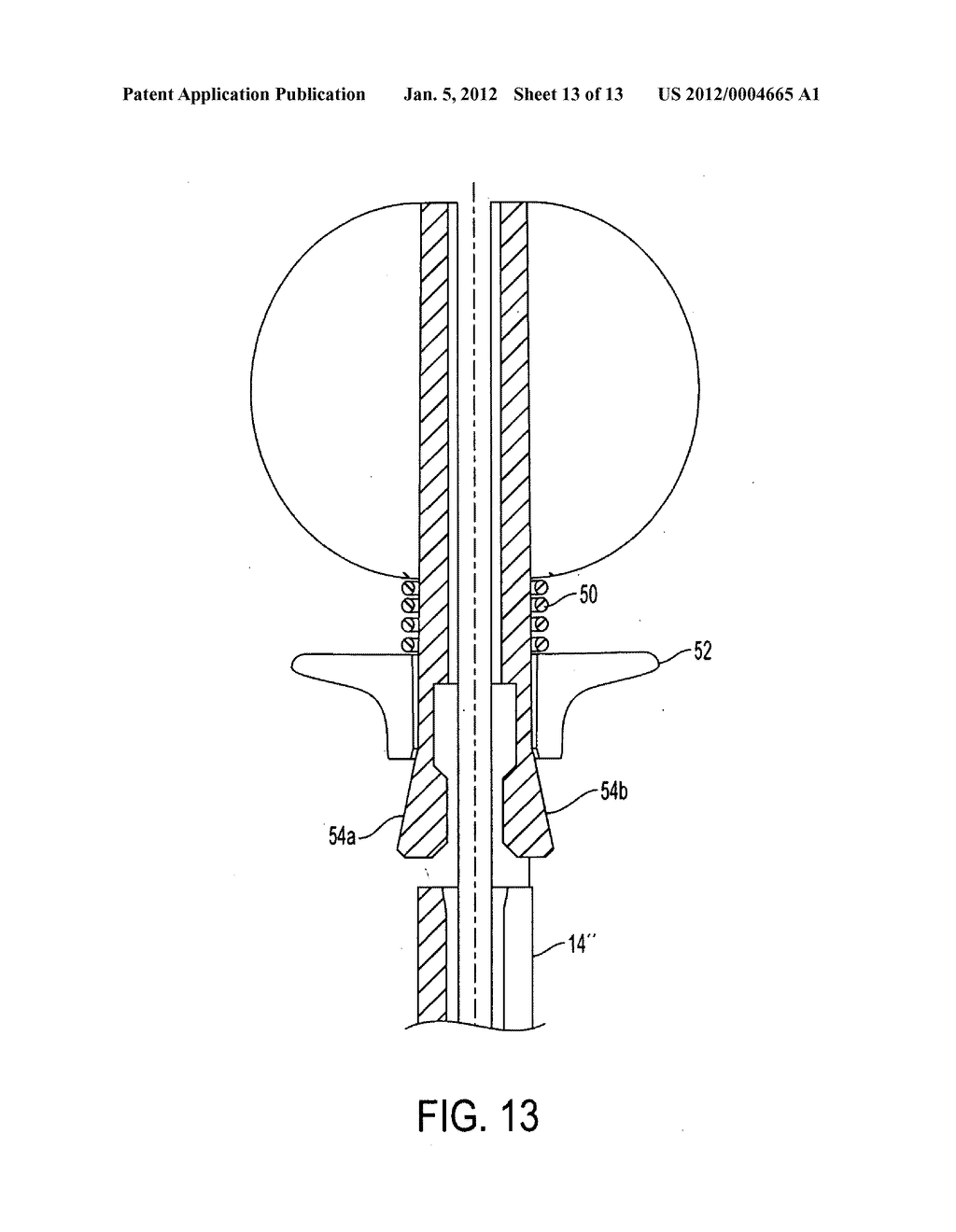 GUIDEWIRE INSERTION METHODS AND DEVICES - diagram, schematic, and image 14