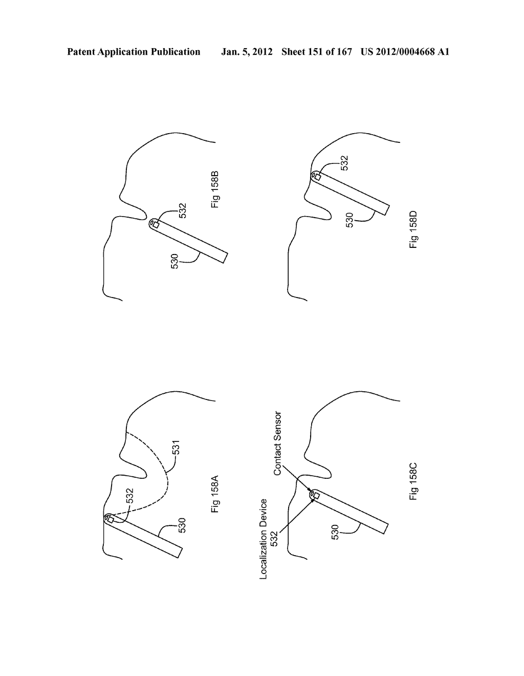 ROBOTIC CATHETER SYSTEM - diagram, schematic, and image 152