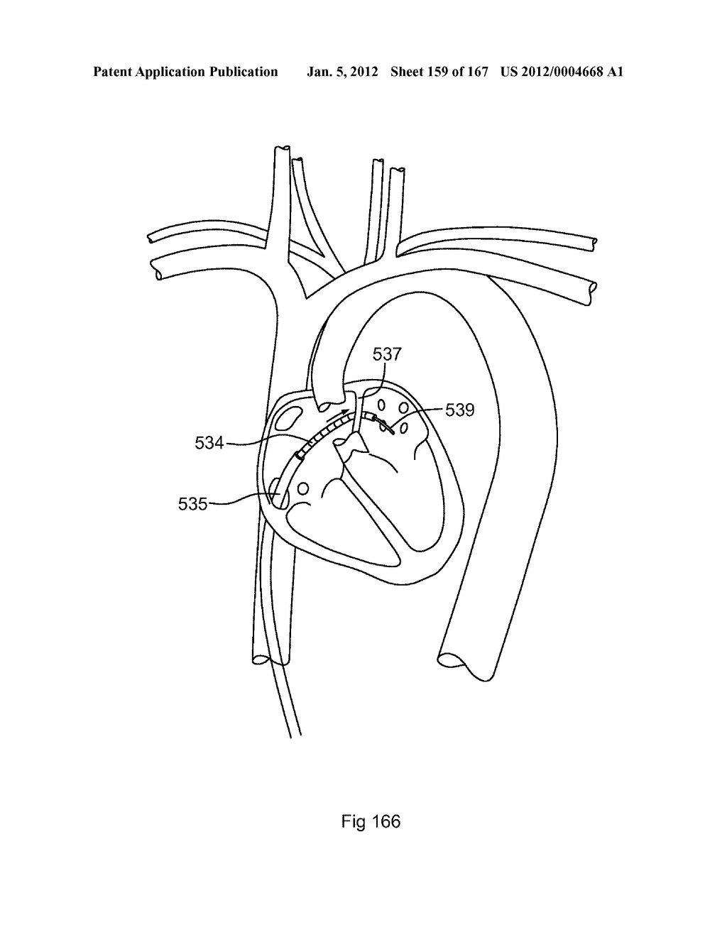 ROBOTIC CATHETER SYSTEM - diagram, schematic, and image 160