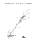 SUTURE LOOP CLOSURE DEVICE diagram and image