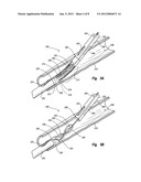 SUTURE LOOP CLOSURE DEVICE diagram and image