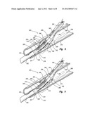 SUTURE LOOP CLOSURE DEVICE diagram and image