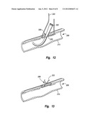 SUTURE LOOP CLOSURE DEVICE diagram and image