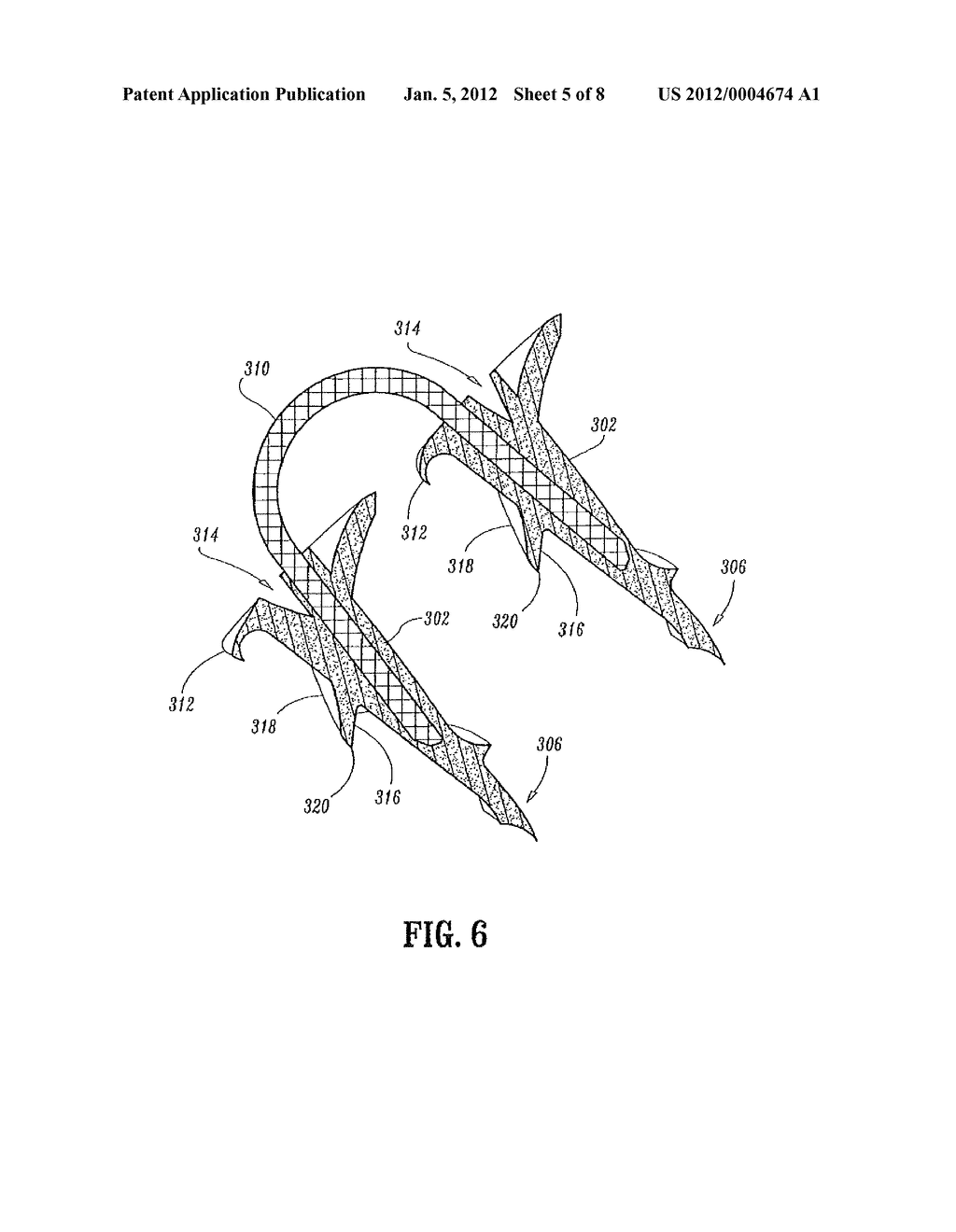 ABSORBABLE FASTENER AND APPLYING APPARATUS - diagram, schematic, and image 06