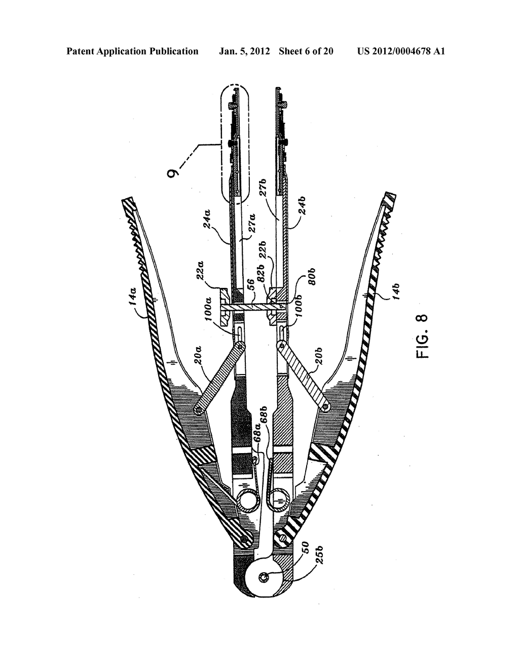 ANASTOMOSIS INSTRUMENT AND METHOD FOR PERFORMING SAME - diagram, schematic, and image 07