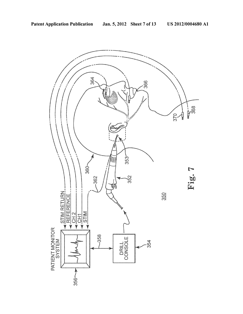 MICRO-RESECTING AND EVOKED POTENTIAL MONITORING SYSTEM AND METHOD - diagram, schematic, and image 08