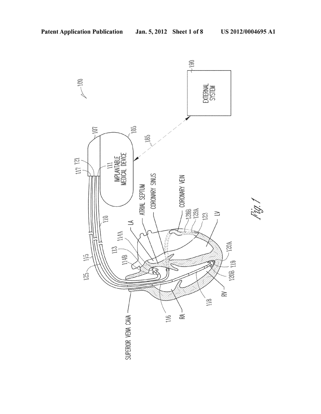 REVERSE PACING-MODE SWITCH - diagram, schematic, and image 02