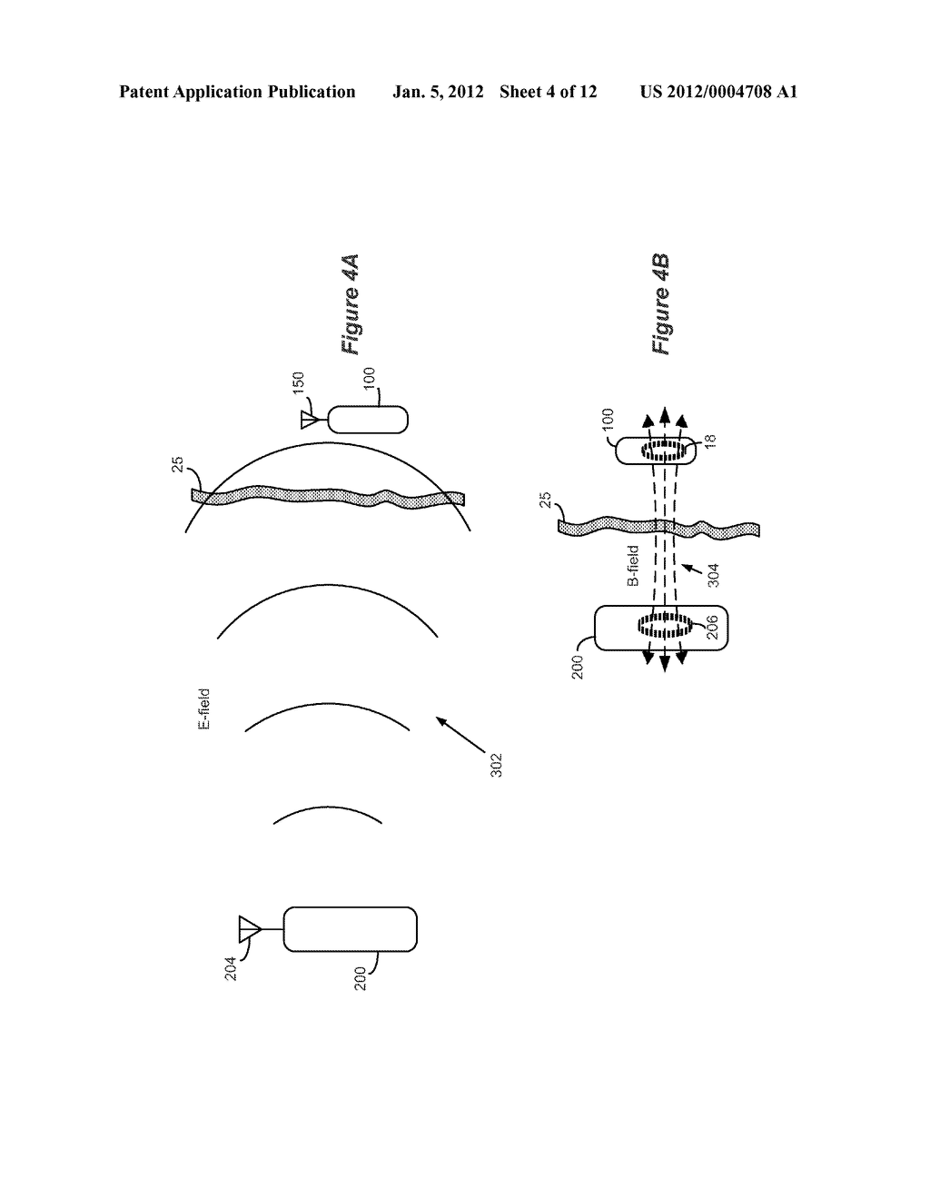 Implantable Medical Device and Charging System Employing Electric Fields - diagram, schematic, and image 05