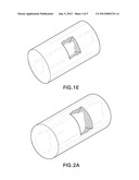 CORE-SHEATH IMPLANT DEVICE HAVING AN INNER CORE LOBE diagram and image