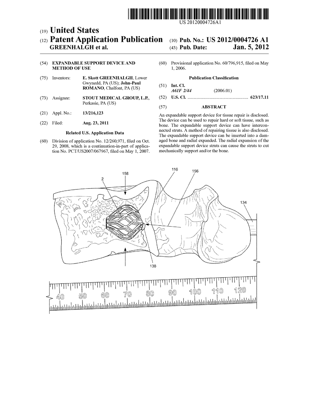 EXPANDABLE SUPPORT DEVICE AND METHOD OF USE - diagram, schematic, and image 01