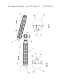 EXPANDABLE SUPPORT DEVICE AND METHOD OF USE diagram and image