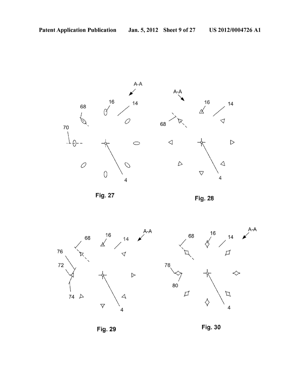 EXPANDABLE SUPPORT DEVICE AND METHOD OF USE - diagram, schematic, and image 10