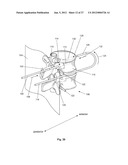 EXPANDABLE SUPPORT DEVICE AND METHOD OF USE diagram and image