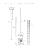 EXPANDABLE SUPPORT DEVICE AND METHOD OF USE diagram and image