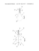 EXPANDABLE SUPPORT DEVICE AND METHOD OF USE diagram and image