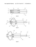 EXPANDABLE SUPPORT DEVICE AND METHOD OF USE diagram and image