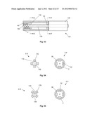 EXPANDABLE SUPPORT DEVICE AND METHOD OF USE diagram and image