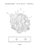 EXPANDABLE SUPPORT DEVICE AND METHOD OF USE diagram and image