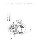 Energy Absorbing Athletic Glove diagram and image