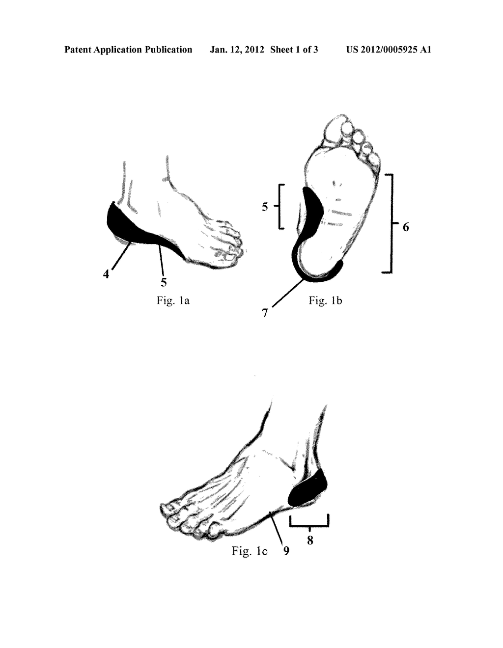 Orthotic Devices and Methods of Manufacture - diagram, schematic, and image 02