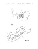 VIOLIN SHOULDER CRADLE diagram and image