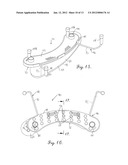 VIOLIN SHOULDER CRADLE diagram and image