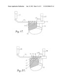 VIOLIN SHOULDER CRADLE diagram and image