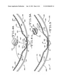 CYLINDRICAL HEAT APPLICATION APPARATUS diagram and image