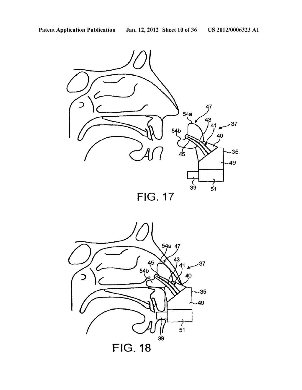 NASAL DEVICES - diagram, schematic, and image 11