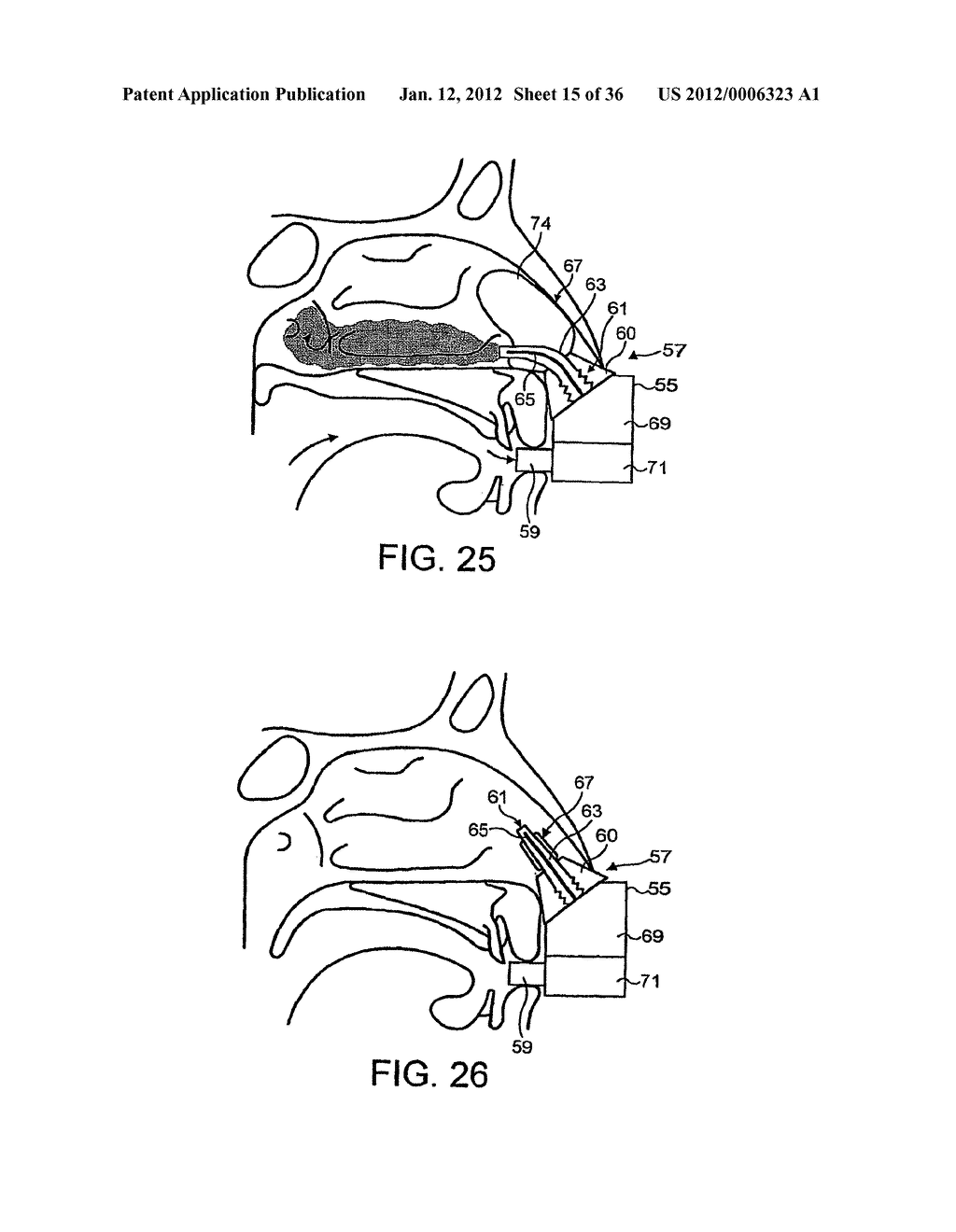 NASAL DEVICES - diagram, schematic, and image 16