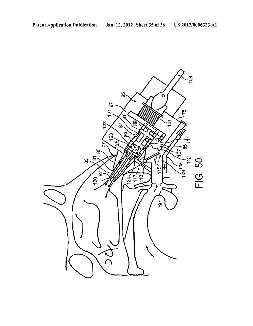 NASAL DEVICES - diagram, schematic, and image 36