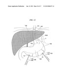 BIOLOGICAL TISSUE TRANSFER METHOD AND BIOLOGICAL TISSUE TREATMENT METHOD diagram and image