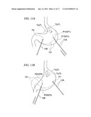 BIOLOGICAL TISSUE TRANSFER METHOD AND BIOLOGICAL TISSUE TREATMENT METHOD diagram and image