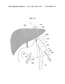 BIOLOGICAL TISSUE TRANSFER METHOD AND BIOLOGICAL TISSUE TREATMENT METHOD diagram and image