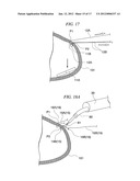 BIOLOGICAL TISSUE TRANSFER METHOD AND BIOLOGICAL TISSUE TREATMENT METHOD diagram and image