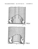 FILTER WITH EXPANDABLE END CAP FACILITATING EASIER CHANGE-OUT diagram and image