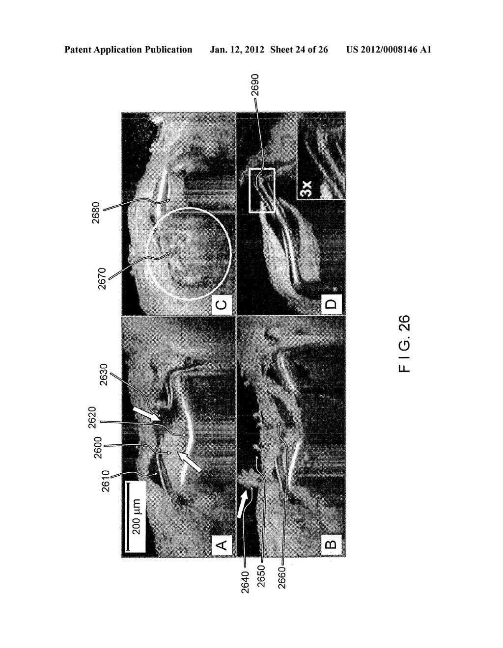 Systems, Methods and Computer-Accessible Medium Which Provide Microscopic     Images of at Least One Anatomical Structure at a Particular Resolution - diagram, schematic, and image 25