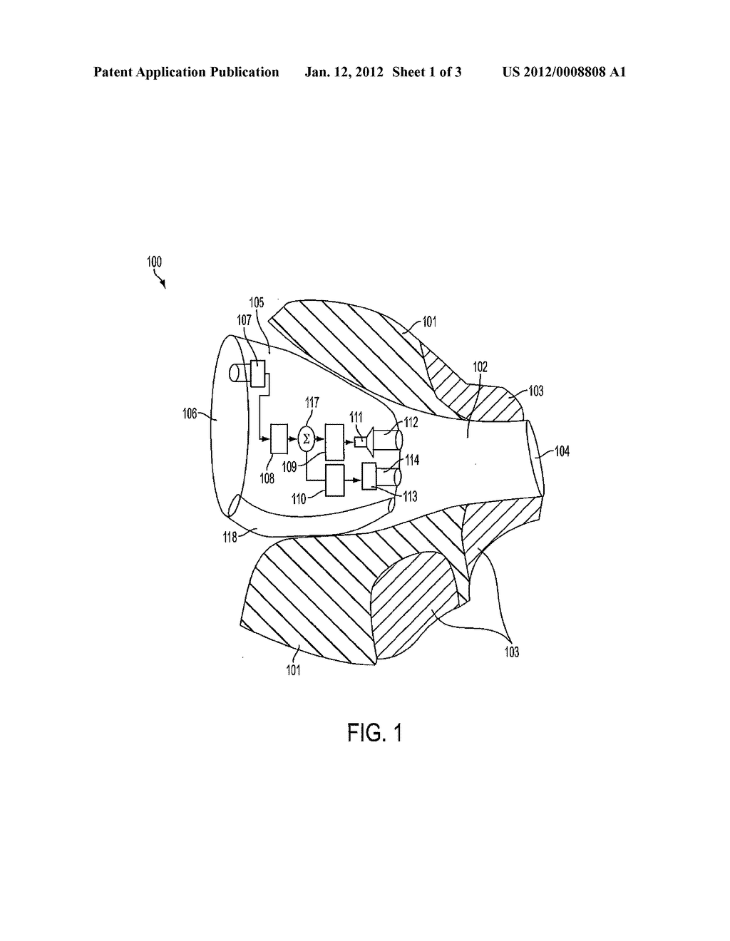 HEARING AID WITH OCCLUSION REDUCTION - diagram, schematic, and image 02