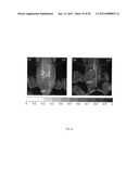 Method and System for Wholesomeness Inspection of Freshly Slaughtered     Chickens on a Processing Line diagram and image