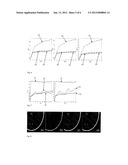 SYSTEM AND METHOD FOR MOTION-COMPENSATED COMPRESSED SENSING FOR DYNAMIC     IMAGING diagram and image