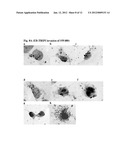 COMPOSITIONS FOR BACTERIAL MEDIATED GENE SILENCING AND METHODS OF USING     THE SAME diagram and image