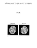 MEANS AND METHODS FOR ACTIVATING VAGUS NERVE diagram and image