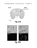 METHODS AND COMPOSITIONS FOR CNS DELIVERY OF ARYLSULFATASE A diagram and image