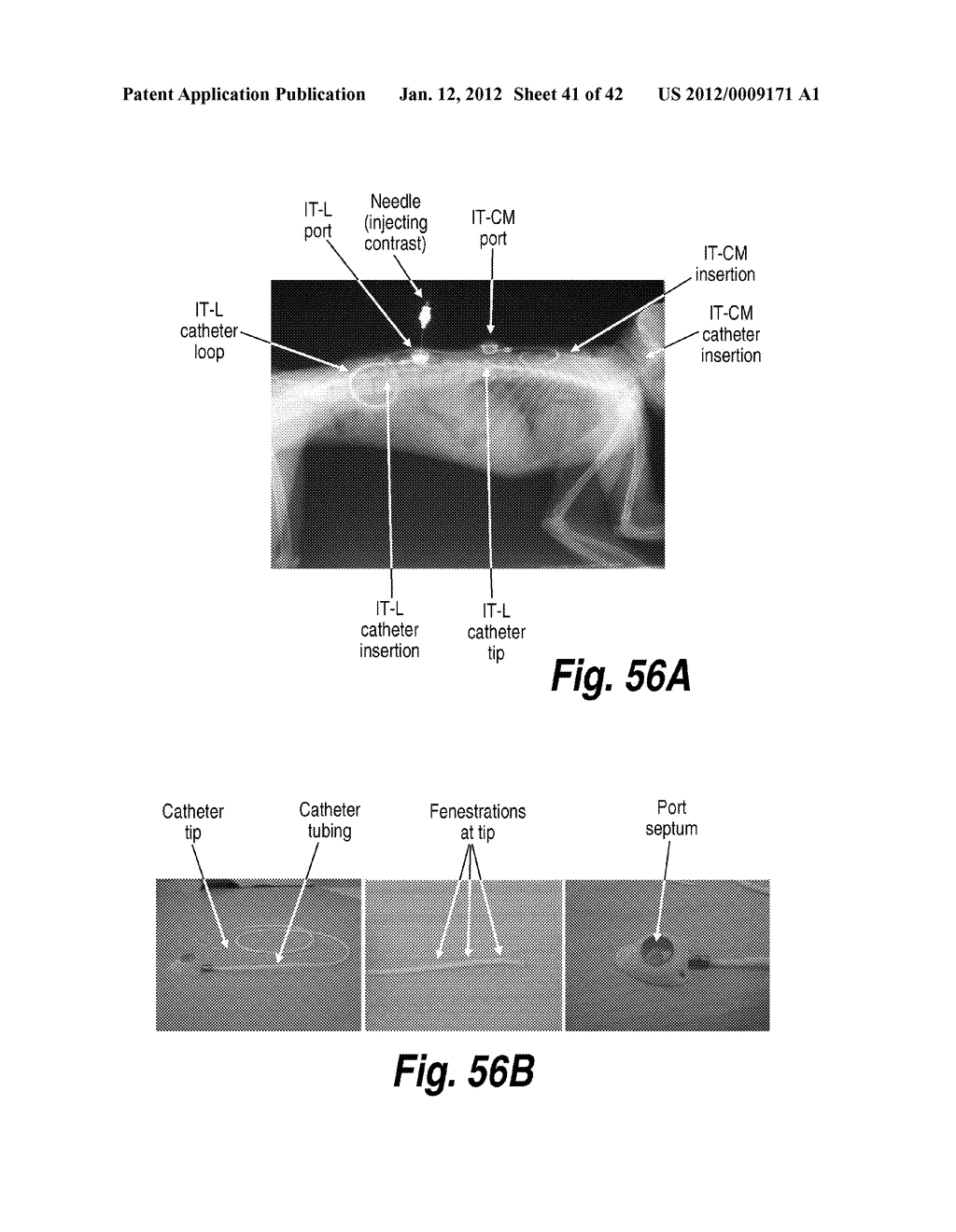 METHODS AND COMPOSITIONS FOR CNS DELIVERY OF ARYLSULFATASE A - diagram, schematic, and image 42