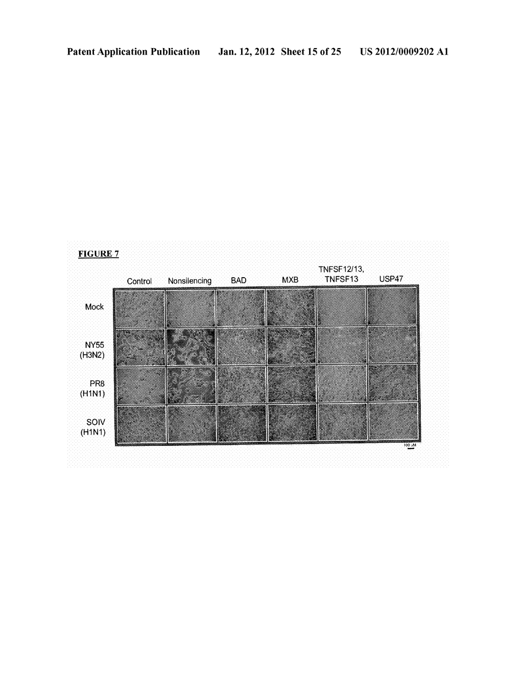 TARGET HOST FACTORS FOR TREATING VIRAL INFECTION - diagram, schematic, and image 16