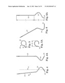 Prolapse Repair diagram and image