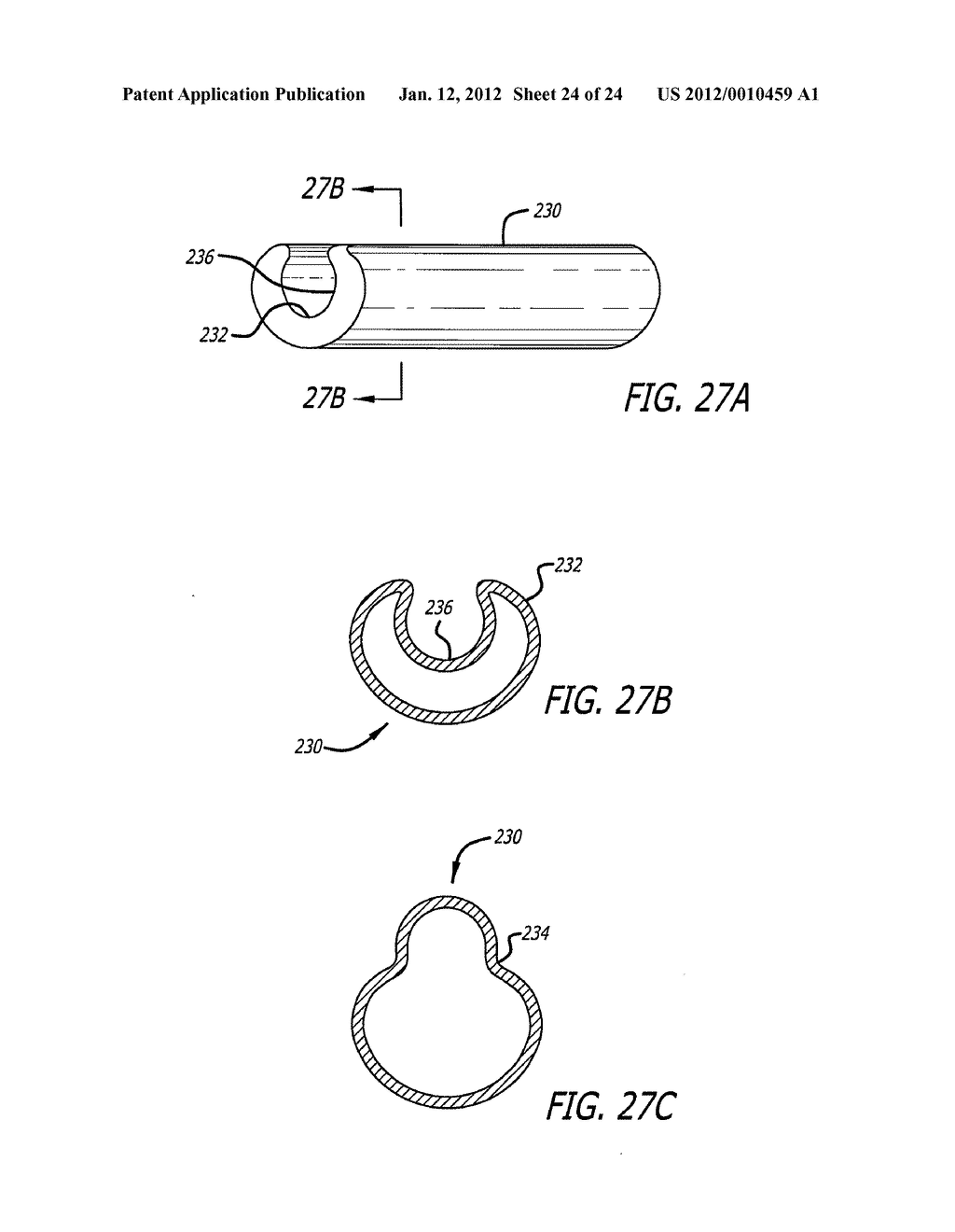 ASSEMBLY AND METHOD FOR AUTOMATICALLY CONTROLLING PRESSURE FOR A GASTRIC     BAND - diagram, schematic, and image 25