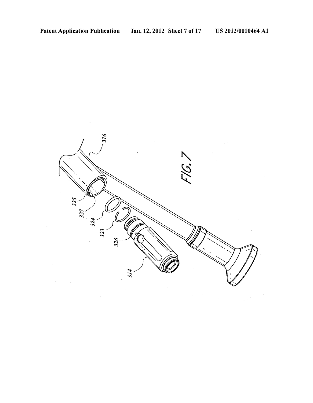 ACCESS SYSTEM WITH REMOVABLE OUTFLOW CHANNEL - diagram, schematic, and image 08