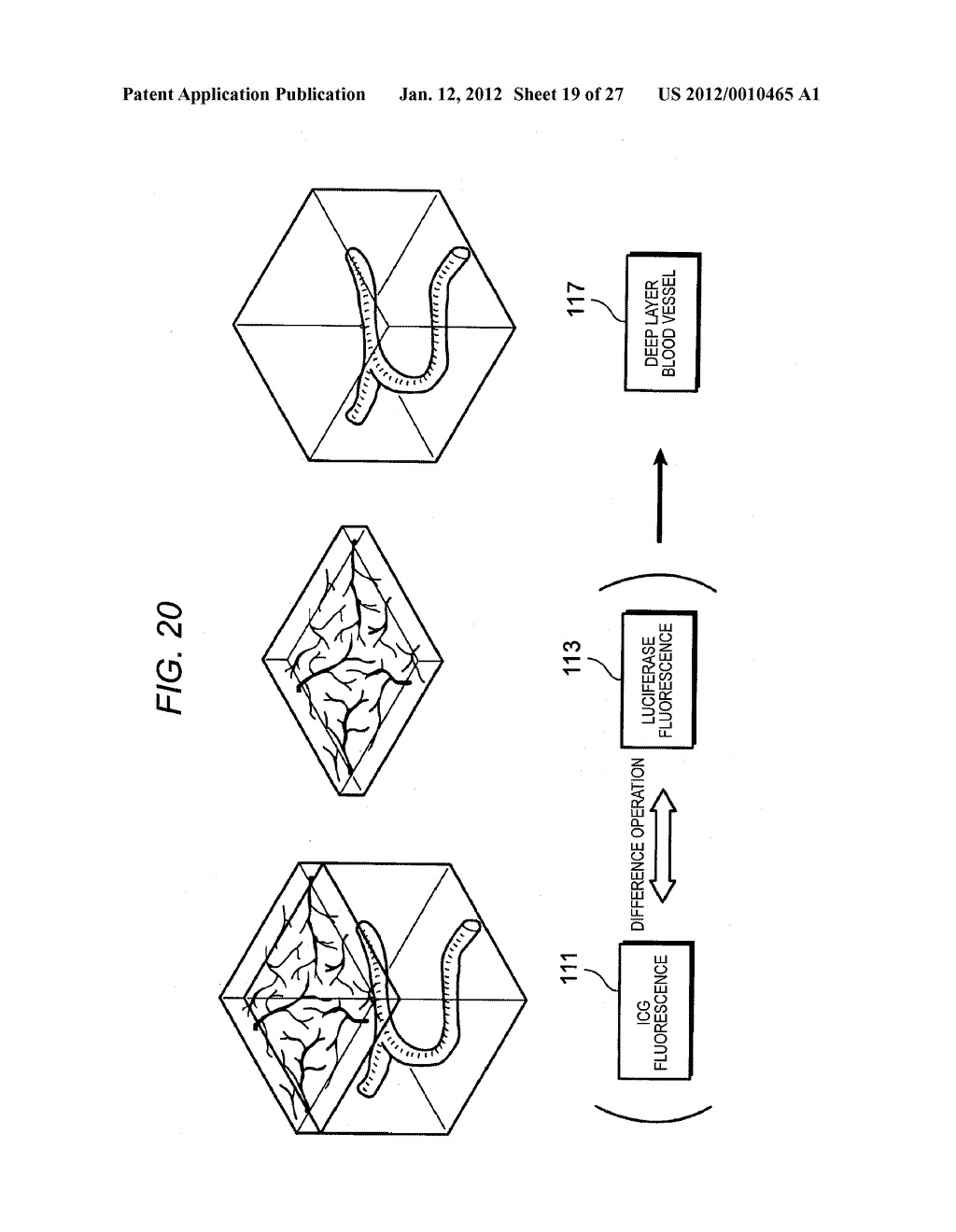 ENDOSCOPE APPARATUS - diagram, schematic, and image 20